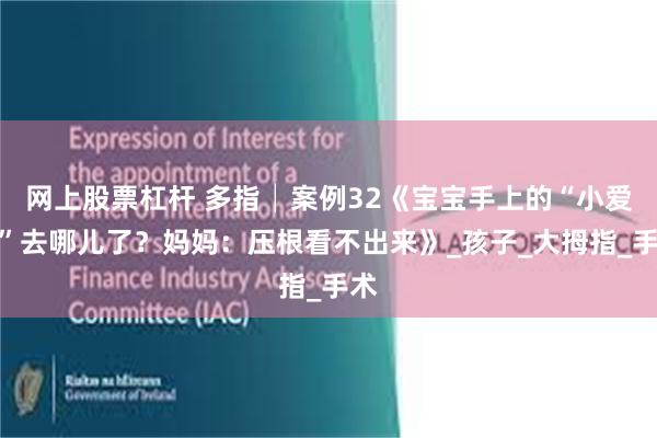 网上股票杠杆 多指│案例32《宝宝手上的“小爱心”去哪儿了？妈妈：压根看不出来》_孩子_大拇指_手术